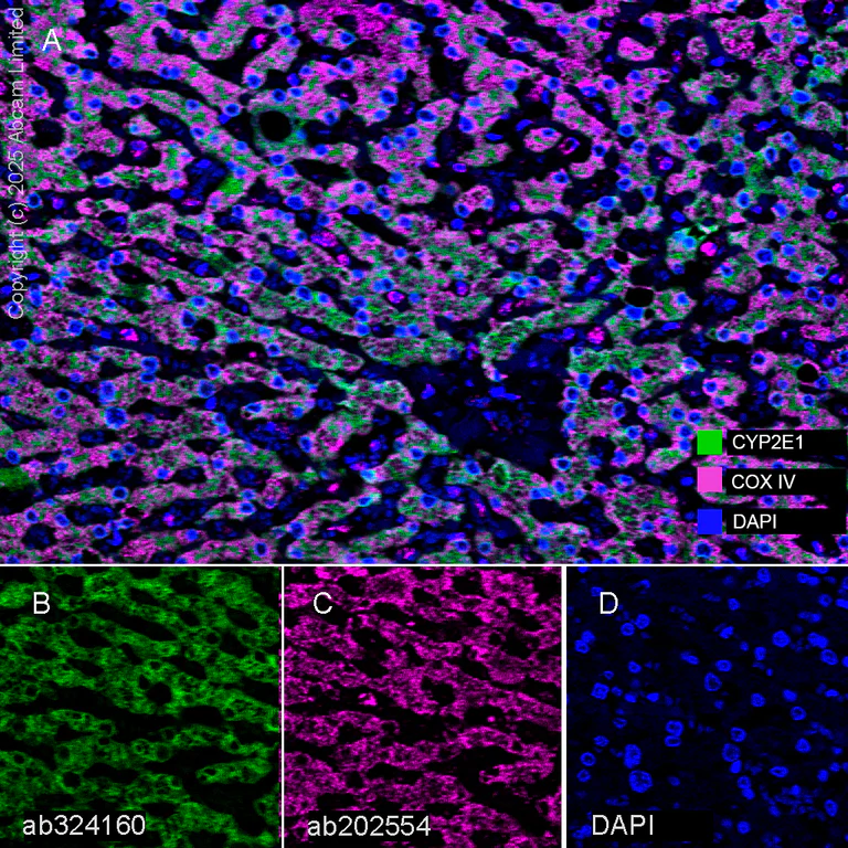 Multiplex immunohistochemistry - Anti-Cytochrome P450 2E1 antibody [EPR28698-543] (AB324160)