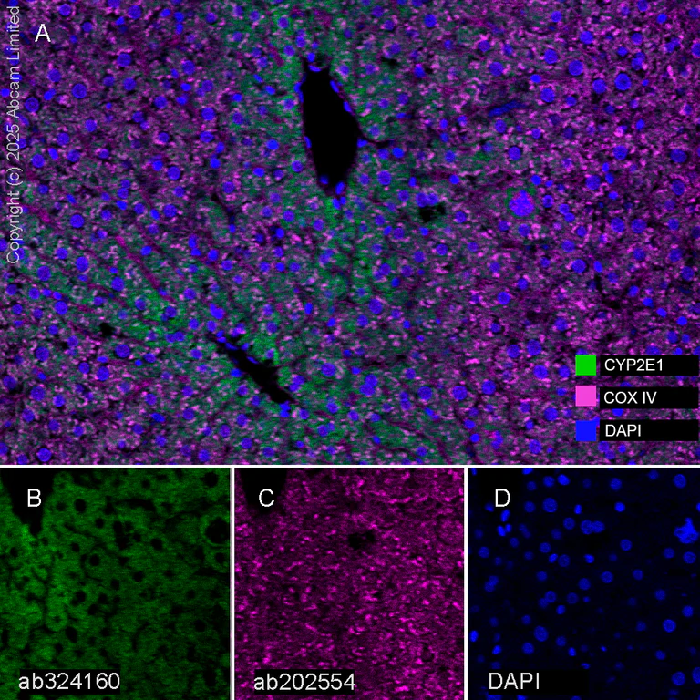 Multiplex immunohistochemistry - Anti-Cytochrome P450 2E1 antibody [EPR28698-543] (AB324160)
