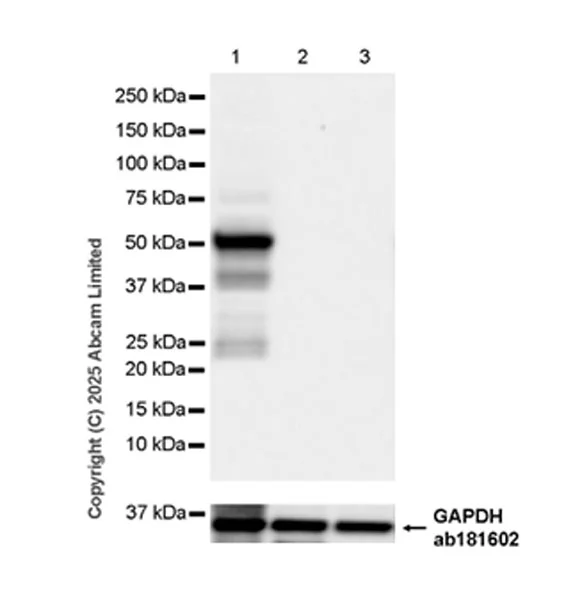 Western blot - Anti-Cytochrome P450 2E1 antibody [EPR28698-543] (AB324160)