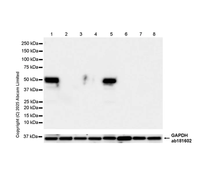 Western blot - Anti-Cytochrome P450 2E1 antibody [EPR28698-543] - BSA and Azide free (AB325963)