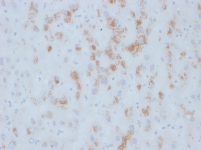Immunohistochemistry (Formalin/PFA-fixed paraffin-embedded sections) - Anti-Cytochrome P450 2E1 antibody [M12P4H2] (AB234408)