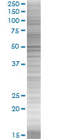 Cytochrome P450 2E1 overexpression 293T lysate (whole cell)