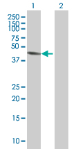 Western blot - Cytochrome P450 2E1 overexpression 293T lysate (whole cell) (AB94254)