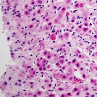 Immunohistochemistry (Formalin/PFA-fixed paraffin-embedded sections) - Anti-Cytochrome P450 3A4/CYP3A4 antibody (AB197053)
