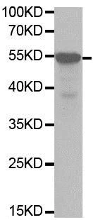 Western blot - Anti-Cytochrome P450 3A4/CYP3A4 antibody (AB197053)