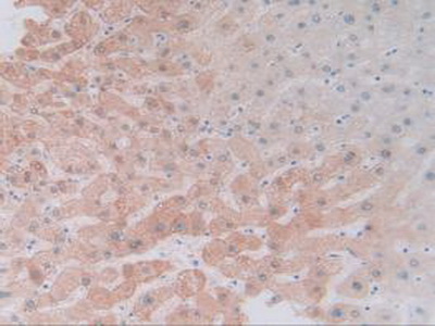 Immunohistochemistry (Formalin/PFA-fixed paraffin-embedded sections) - Anti-Cytochrome P450 3A4/CYP3A4 antibody (AB231816)