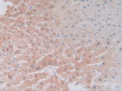 Immunohistochemistry (Formalin/PFA-fixed paraffin-embedded sections) - Anti-Cytochrome P450 3A4/CYP3A4 antibody (AB231816)