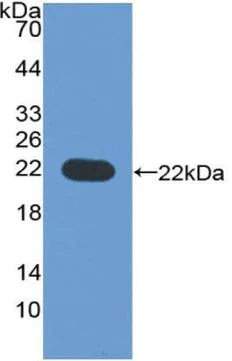 Western blot - Anti-Cytochrome P450 3A4/CYP3A4 antibody (AB231816)