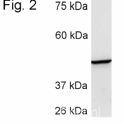 Western blot - Anti-Cytochrome P450 3A4/CYP3A4 antibody (AB3572), expandable thumbnail