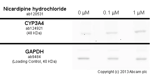 Western blot - Anti-Cytochrome P450 3A4/CYP3A4 antibody [EPR6202] (AB124921)