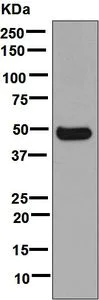 Western blot - Anti-Cytochrome P450 3A4/CYP3A4 antibody [EPR6202] (AB124921)
