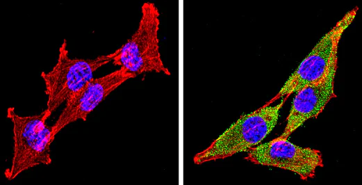 Immunocytochemistry/ Immunofluorescence - Anti-Cytochrome P450 4A/CYP4A11 antibody (AB3573)