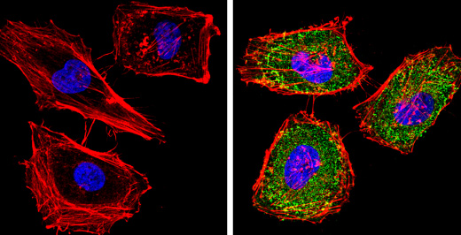 Immunocytochemistry/ Immunofluorescence - Anti-Cytochrome P450 4A/CYP4A11 antibody (AB3573)