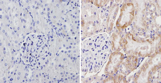 Immunohistochemistry (Formalin/PFA-fixed paraffin-embedded sections) - Anti-Cytochrome P450 4A/CYP4A11 antibody (AB3573)