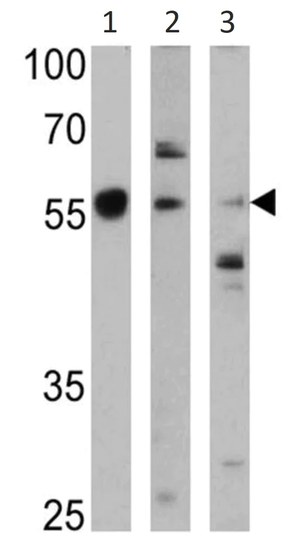 Western blot - Anti-Cytochrome P450 4A/CYP4A11 antibody (AB3573)
