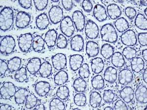 Immunohistochemistry (Formalin/PFA-fixed paraffin-embedded sections) - Anti-Cytochrome P450 4A/CYP4A11 antibody [EPR8276] - BSA and Azide free (AB248918)