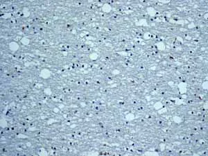 Immunohistochemistry (Formalin/PFA-fixed paraffin-embedded sections) - Anti-Cytochrome P450 4A/CYP4A11 antibody [EPR8276] - BSA and Azide free (AB248918)