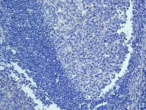 Immunohistochemistry (Formalin/PFA-fixed paraffin-embedded sections) - Anti-Cytochrome P450 4A/CYP4A11 antibody [EPR8276] - BSA and Azide free (AB248918)