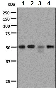 Western blot - Anti-Cytochrome P450 4A/CYP4A11 antibody [EPR8276] - BSA and Azide free (AB248918)