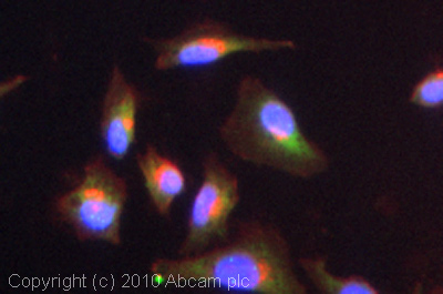Immunocytochemistry/ Immunofluorescence - Anti-Cytochrome P450 Reductase antibody (AB13513)