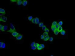 Immunocytochemistry/ Immunofluorescence - Anti-Cytochrome P450 Reductase antibody [EPR14479(B)] (AB180597)