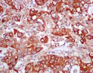 Immunohistochemistry (Formalin/PFA-fixed paraffin-embedded sections) - Anti-Cytochrome P450 Reductase antibody [EPR14479(B)] (AB180597)