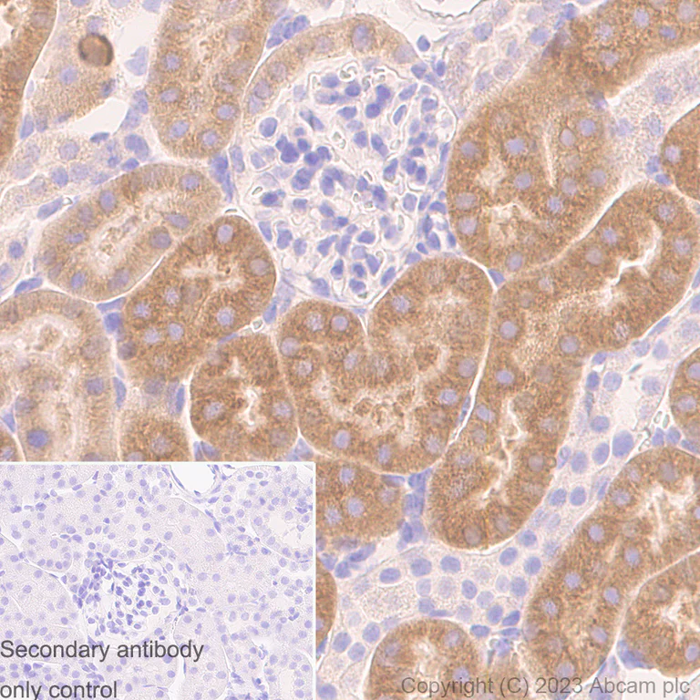 Immunohistochemistry (Formalin/PFA-fixed paraffin-embedded sections) - Anti-Cytochrome P450 Reductase antibody [EPR14479(B)] (AB180597)