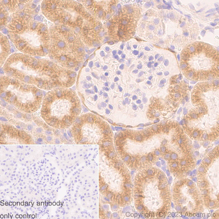 Immunohistochemistry (Formalin/PFA-fixed paraffin-embedded sections) - Anti-Cytochrome P450 Reductase antibody [EPR14479(B)] (AB180597)