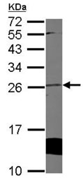 Western blot - Anti-Cytoglobin antibody (AB127028)