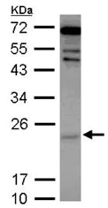 Western blot - Anti-Cytoglobin antibody (AB127028)