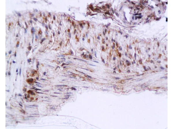 Immunohistochemistry (Formalin/PFA-fixed paraffin-embedded sections) - Anti-Cytoglobin antibody (AB202972)