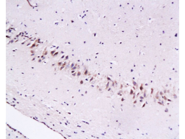 Immunohistochemistry (Formalin/PFA-fixed paraffin-embedded sections) - Anti-Cytoglobin antibody (AB202972)