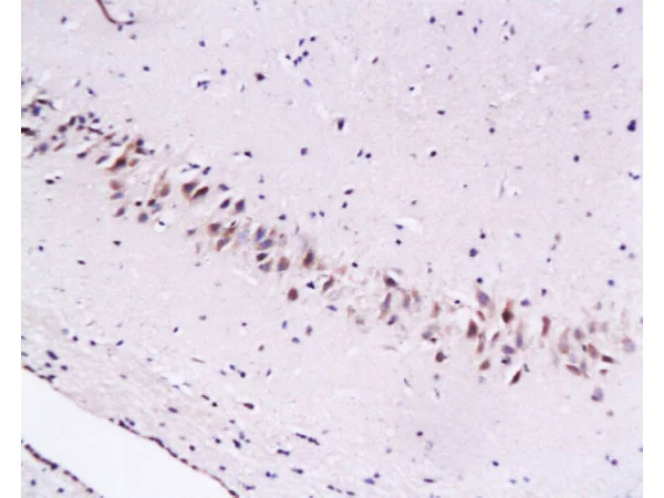 Immunohistochemistry (Formalin/PFA-fixed paraffin-embedded sections) - Anti-Cytoglobin antibody (AB202972)