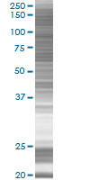 Cytohesin 2 overexpression 293T lysate (whole cell)