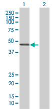 Western blot - Cytohesin 2 overexpression 293T lysate (whole cell) (AB94253)