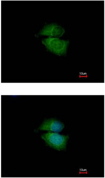 Immunocytochemistry/ Immunofluorescence - Anti-Cytohesin 3 antibody (AB155691), expandable thumbnail