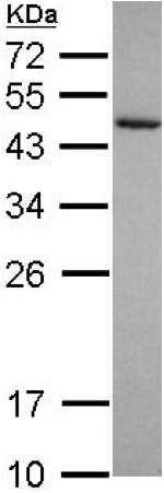 Western blot - Anti-Cytohesin 3 antibody (AB155691), expandable thumbnail