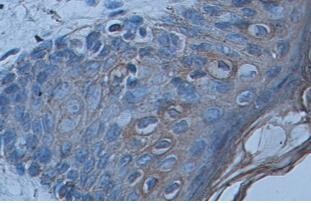 Immunohistochemistry (Formalin/PFA-fixed paraffin-embedded sections) - Anti-Cytokeratin 1 antibody (AB93652)