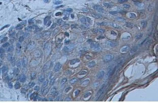 Immunohistochemistry (Formalin/PFA-fixed paraffin-embedded sections) - Anti-Cytokeratin 1 antibody (AB93652)