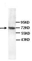 Western blot - Anti-Cytokeratin 1 antibody (AB93652)