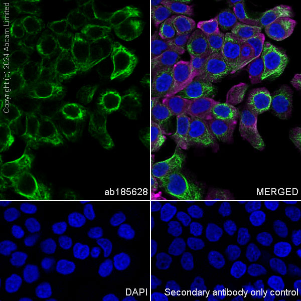 Immunocytochemistry/ Immunofluorescence - Anti-Cytokeratin 1 antibody [EPR17744] (ab185628), expandable thumbnail