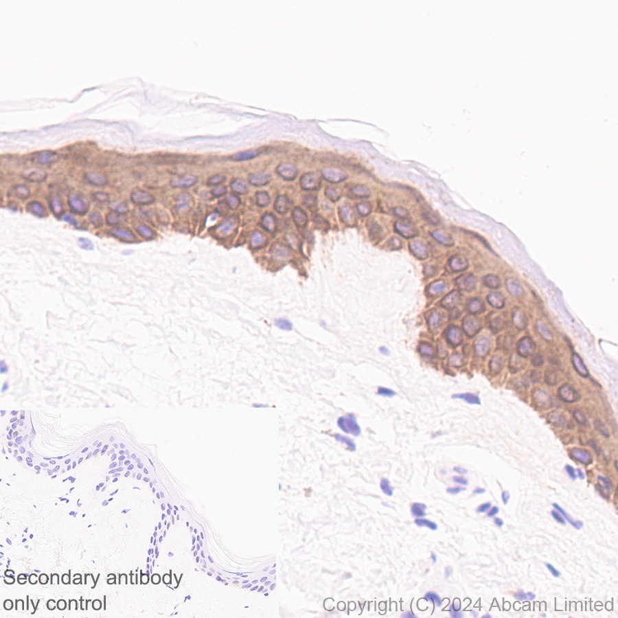 Immunohistochemistry (Formalin/PFA-fixed paraffin-embedded sections) - Anti-Cytokeratin 1 antibody [EPR17744] (ab185628), expandable thumbnail