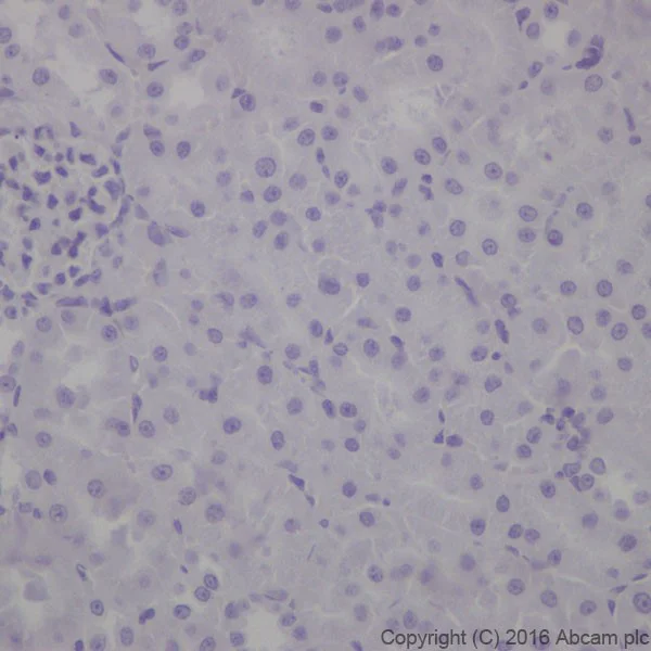 Immunohistochemistry (Formalin/PFA-fixed paraffin-embedded sections) - Anti-Cytokeratin 1 antibody [EPR17744] - BSA and Azide free (AB250844)