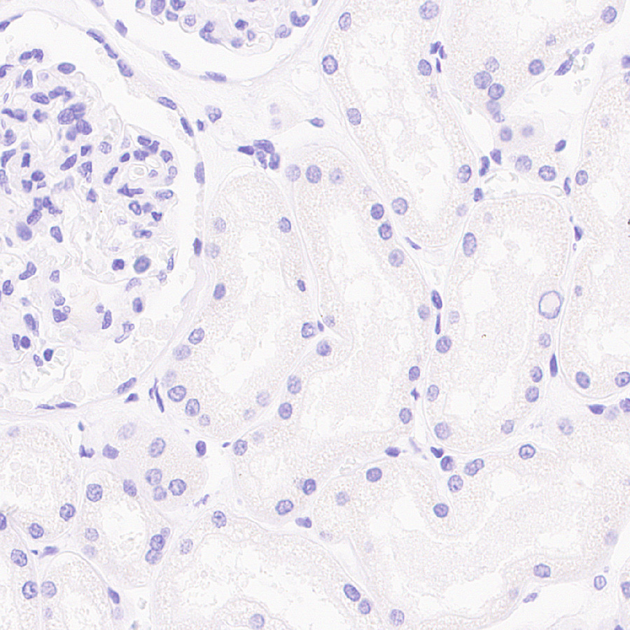 Immunohistochemistry (Formalin/PFA-fixed paraffin-embedded sections) - Anti-Cytokeratin 1 antibody [EPR17744] - BSA and Azide free (AB250844)