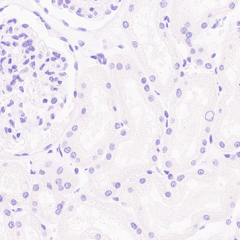 Immunohistochemistry (Formalin/PFA-fixed paraffin-embedded sections) - Anti-Cytokeratin 1 antibody [EPR17744] - BSA and Azide free (AB250844)
