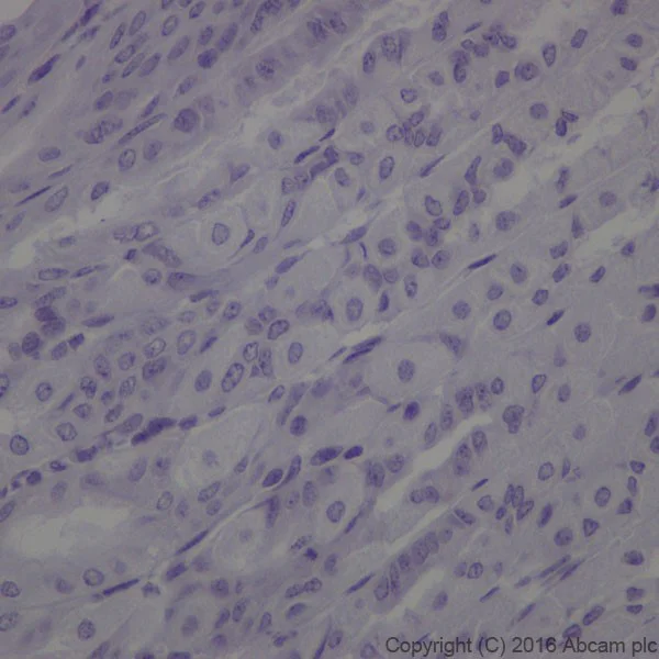 Immunohistochemistry (Formalin/PFA-fixed paraffin-embedded sections) - Anti-Cytokeratin 1 antibody [EPR17744] - BSA and Azide free (AB250844)