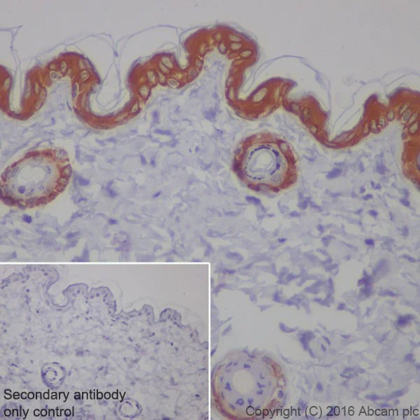 Immunohistochemistry (Formalin/PFA-fixed paraffin-embedded sections) - Anti-Cytokeratin 1 antibody [EPR17744] - BSA and Azide free (AB250844)
