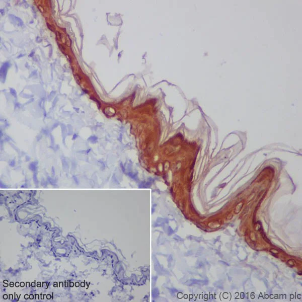 Immunohistochemistry (Formalin/PFA-fixed paraffin-embedded sections) - Anti-Cytokeratin 1 antibody [EPR17744] - BSA and Azide free (AB250844)