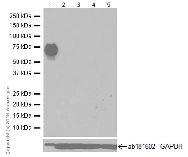 Western blot - Anti-Cytokeratin 1 antibody [EPR17744] - BSA and Azide free (AB250844)