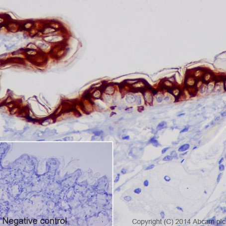 Immunohistochemistry (Formalin/PFA-fixed paraffin-embedded sections) - Anti-Cytokeratin 1 antibody [EPR17870] (AB185629), expandable thumbnail